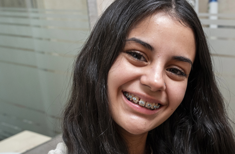 Metal Braces 3 of 3