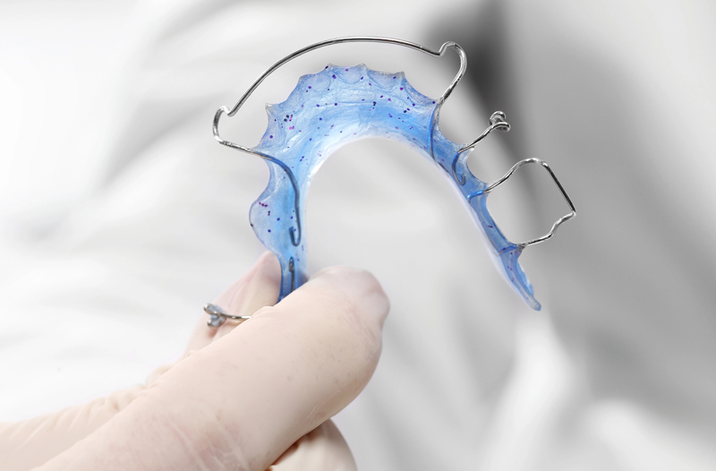Removable Braces 3 of 3