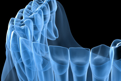 Timeline 3D Teeth